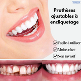 Facettes Dentaires PerfectSmile - TZ